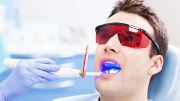 абфракционный дефект зубов